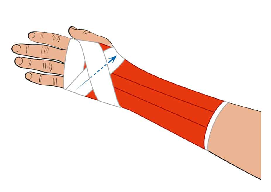Bandage du poignet avec bandes de kinésiologie - instructions