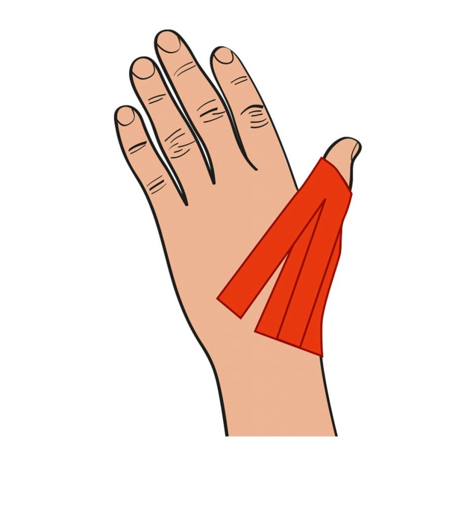 Tendinite du poignet (de Quervain) : Comment se faire un bandage taping ? 