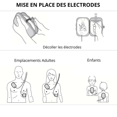 mode d'emploi placement électrodes