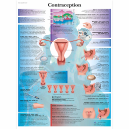 La contraception