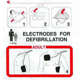 Électrodes adulte pré-connectées FRED EASY PORT Schiller